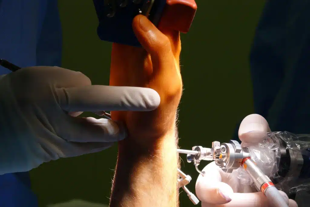 Clinician providing advanced wound care treatment
