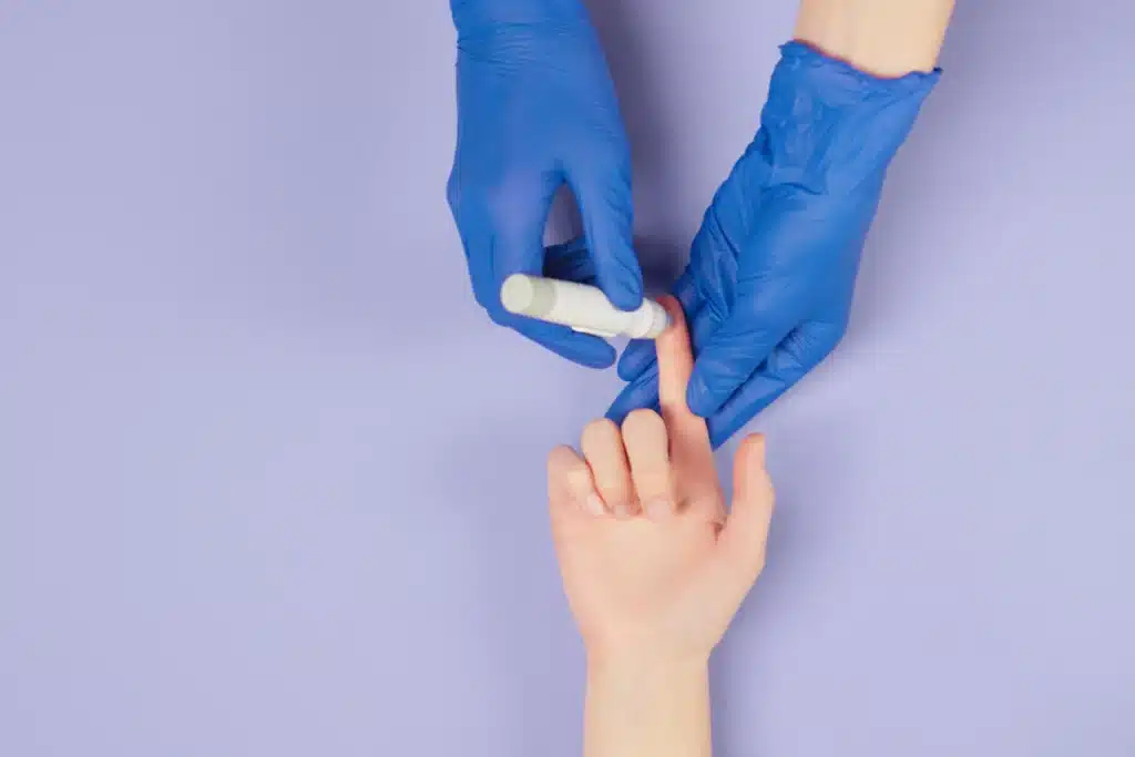 Diabetic ulcer being assessed and dressed by a wound care clinician